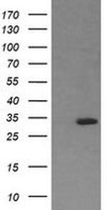 RARRES1 Antibody in Western Blot (WB)