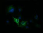 DNM1L Antibody in Immunocytochemistry (ICC/IF)