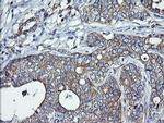 DNM1L Antibody in Immunohistochemistry (Paraffin) (IHC (P))