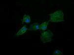 DNM1L Antibody in Immunocytochemistry (ICC/IF)