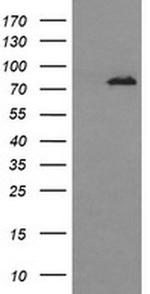 DNM1L Antibody in Western Blot (WB)