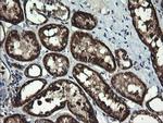 ACAA2 Antibody in Immunohistochemistry (Paraffin) (IHC (P))