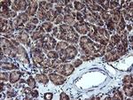 ACAA2 Antibody in Immunohistochemistry (Paraffin) (IHC (P))