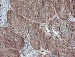 ACAA2 Antibody in Immunohistochemistry (Paraffin) (IHC (P))