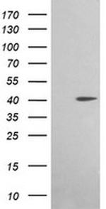 ACAA2 Antibody in Western Blot (WB)