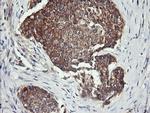 DNM1L Antibody in Immunohistochemistry (Paraffin) (IHC (P))