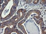 DNM1L Antibody in Immunohistochemistry (Paraffin) (IHC (P))