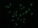 ACAA2 Antibody in Immunocytochemistry (ICC/IF)