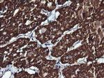 ACAA2 Antibody in Immunohistochemistry (Paraffin) (IHC (P))