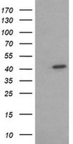 ACAA2 Antibody in Western Blot (WB)