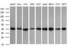 ACAA2 Antibody in Western Blot (WB)