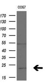 APC11 Antibody in Western Blot (WB)