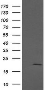 APC11 Antibody in Western Blot (WB)