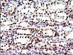 PMS2 Antibody in Immunohistochemistry (Paraffin) (IHC (P))