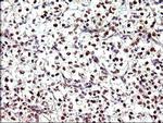 PMS2 Antibody in Immunohistochemistry (Paraffin) (IHC (P))