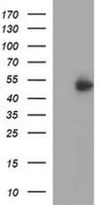 IFNGR2 Antibody in Western Blot (WB)