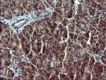 RUNDC3A Antibody in Immunohistochemistry (Paraffin) (IHC (P))