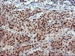 RAPGEF1 Antibody in Immunohistochemistry (Paraffin) (IHC (P))