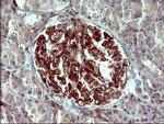 PPAP2A Antibody in Immunohistochemistry (Paraffin) (IHC (P))