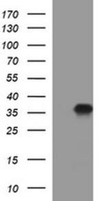 PPAP2A Antibody in Western Blot (WB)