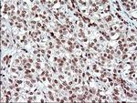 POLR3GL Antibody in Immunohistochemistry (Paraffin) (IHC (P))