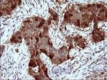 SERPINB3 Antibody in Immunohistochemistry (Paraffin) (IHC (P))