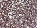 IL10RA Antibody in Immunohistochemistry (Paraffin) (IHC (P))