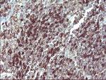 IL10RA Antibody in Immunohistochemistry (Paraffin) (IHC (P))