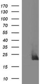 C17orf62 Antibody in Western Blot (WB)