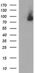 JPH2 Antibody in Western Blot (WB)