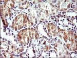 HERPUD1 Antibody in Immunohistochemistry (Paraffin) (IHC (P))