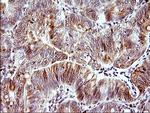 HERPUD1 Antibody in Immunohistochemistry (Paraffin) (IHC (P))