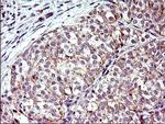 TOLLIP Antibody in Immunohistochemistry (Paraffin) (IHC (P))