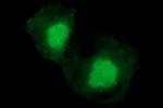 CHAC1 Antibody in Immunocytochemistry (ICC/IF)