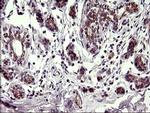 CHAC1 Antibody in Immunohistochemistry (Paraffin) (IHC (P))