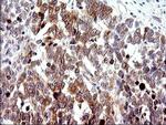 CHAC1 Antibody in Immunohistochemistry (Paraffin) (IHC (P))