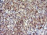 CHAC1 Antibody in Immunohistochemistry (Paraffin) (IHC (P))