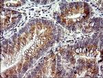 CHAC1 Antibody in Immunohistochemistry (Paraffin) (IHC (P))