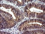 CHAC1 Antibody in Immunohistochemistry (Paraffin) (IHC (P))