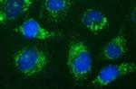 HSD17B4 Antibody in Immunocytochemistry (ICC/IF)