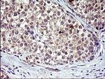 HSD17B4 Antibody in Immunohistochemistry (Paraffin) (IHC (P))