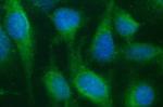 SR-BI Antibody in Immunocytochemistry (ICC/IF)