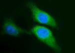 SPHK1 Antibody in Immunocytochemistry (ICC/IF)