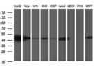 TXNDC5 Antibody in Western Blot (WB)