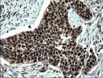 RPRD1B Antibody in Immunohistochemistry (Paraffin) (IHC (P))