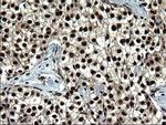 RPRD1B Antibody in Immunohistochemistry (Paraffin) (IHC (P))