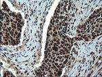 RPRD1B Antibody in Immunohistochemistry (Paraffin) (IHC (P))