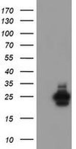 UBE2E3 Antibody in Western Blot (WB)