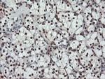 UBE2E3 Antibody in Immunohistochemistry (Paraffin) (IHC (P))