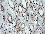 UBE2E3 Antibody in Immunohistochemistry (Paraffin) (IHC (P))